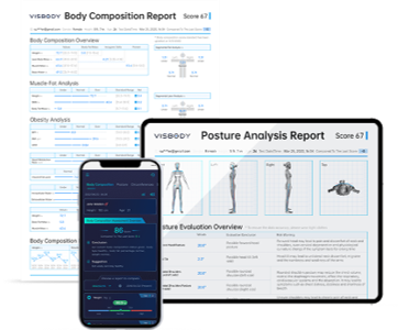VISBODY SUPPORTS RAPPORT
